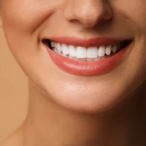 Close-up of a woman's smile with white veneers